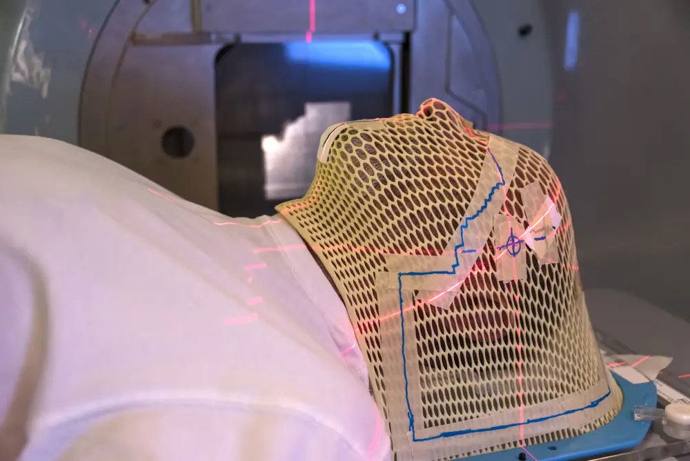 Proton beam therapy targets and destroys cancer cells with highly advanced precision