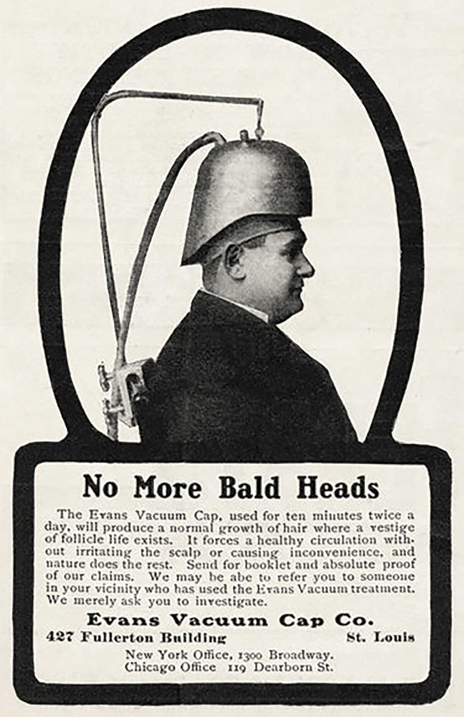 Advertisement for a specious hair-restoration device known as the Evans Vacuum Cap, circa 1905. The device purported to work by creating vacuum pressure on the scalp, stimulating blood flow and new hair growth. Advertisement for a specious hair-restoration device known as the Evans Vacuum Cap, circa 1905. The device purported to work by creating vacuum pressure on the scalp, stimulating blood flow and new hair growth.